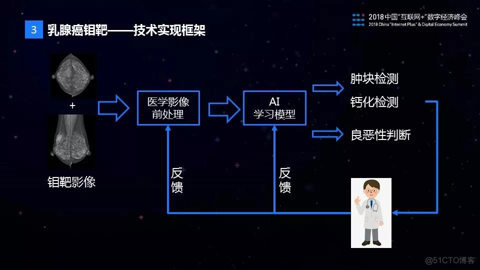 腾讯在乳腺癌影像AI诊断方向的探索_AI_06