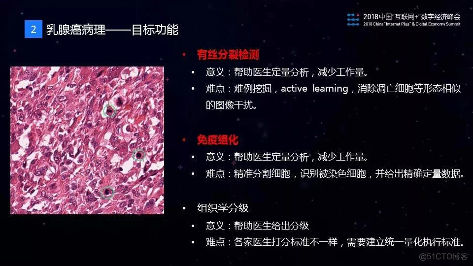 腾讯在乳腺癌影像AI诊断方向的探索_AI_12