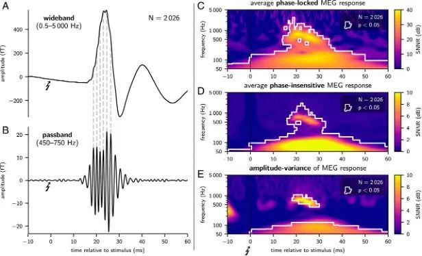 pnas:人类首次利用新型脑磁图可视化快速大脑信号