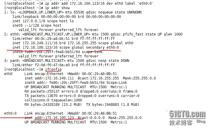 Linux网络属性的管理_ifcfg家族命令和ip _20