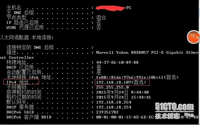 设置为自动获得IP地址，如何查看当前的IP地址_IP地址_02