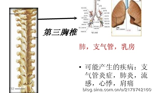 脊椎与人体疾病的关系_人体疾病与胸椎_10