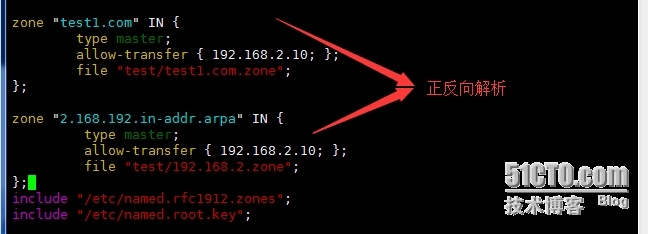 Linux之DNS与BIND_bind_17