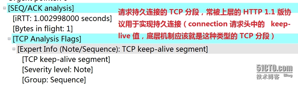 TcpIP协议,HTTP,DNS 实战:基于wireshark与BurpSuite抓包分析_wireshark_20