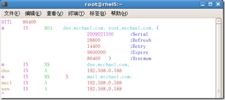 [RHEL5企业级Linux服务攻略]--第4季 DNS服务全攻略_DNS_12