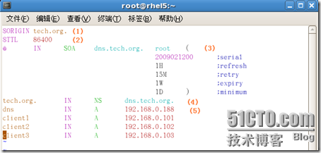 [RHEL5企业级Linux服务攻略]--第4季 DNS服务全攻略_Linux_22