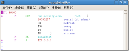 [RHEL5企业级Linux服务攻略]--第4季 DNS服务全攻略_RHEL_82