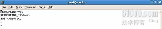 RHEL5安装Oracle10gRAC on VMware Server1.0之一_Oracle19gRAC on VMwa_59