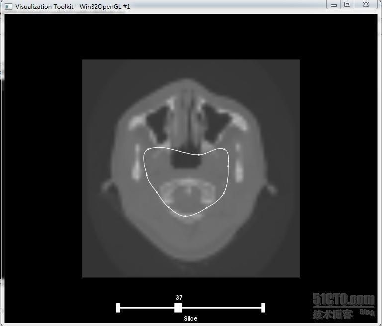 vtkimageviewer 和vtkcontourwidget交互提取感兴趣区域！_vtkimageviewer 