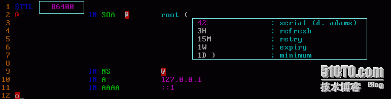 linux下DNS服务器的配置（一）（基础相关）_BIND_07