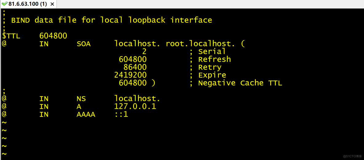 Linux 中 DNS 部署_DNS_25