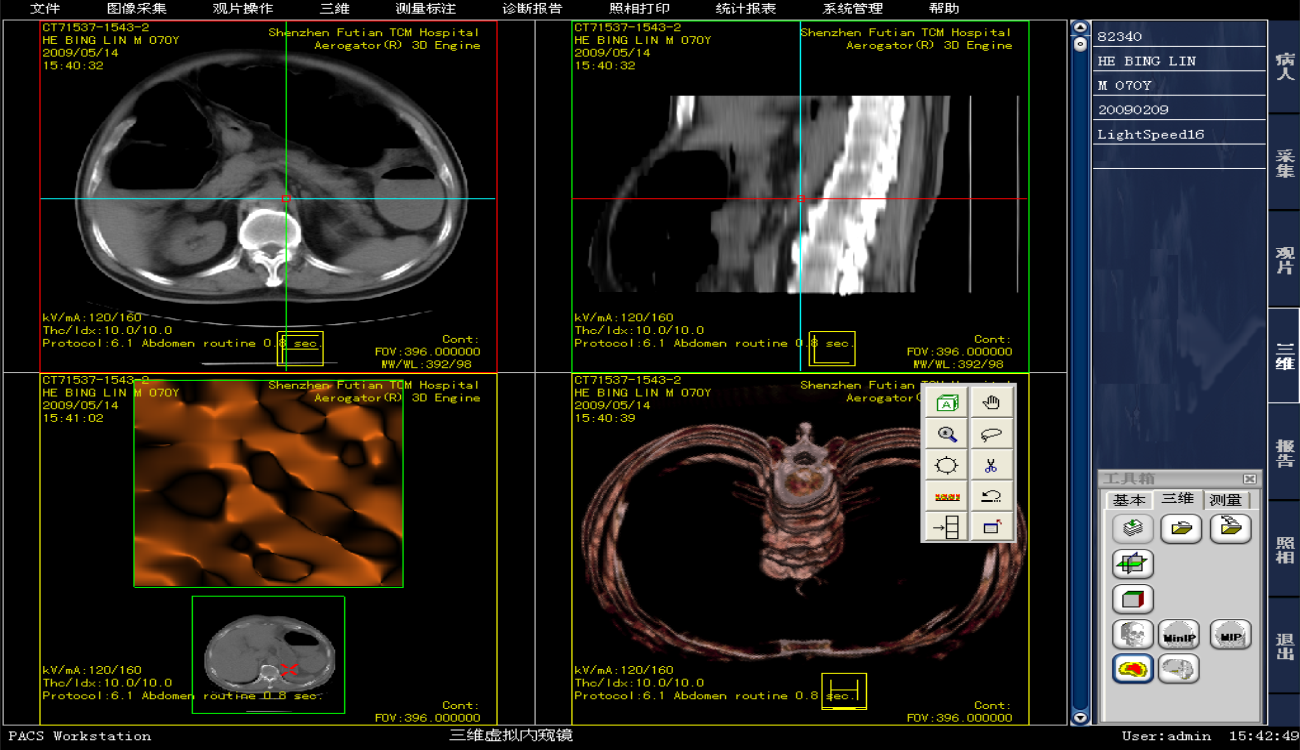 ​医院医学影像PACS系统源码，三维多平面重建、三维容积重建、心脏动脉钙化分析_工作流程_03