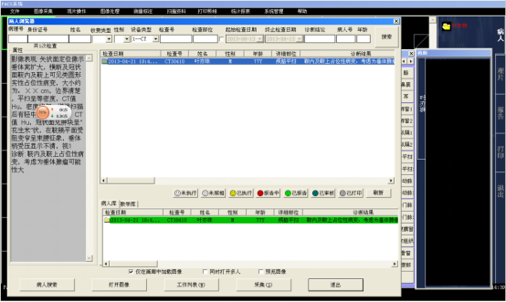 PACS系统源码 新一代的医学图像管理系统 云影像,PACS云胶片,PACS影像工作站系统源码_提高工作效率_04