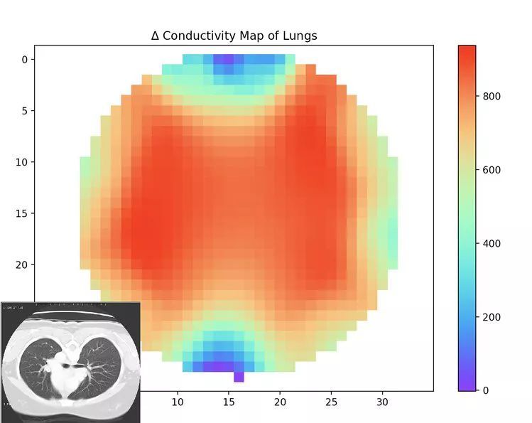 初探Spectra：全球首个开源医疗影像系统_java_04