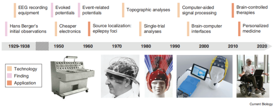带你快速了解脑电图（EEG）发展历史及前景_java_06