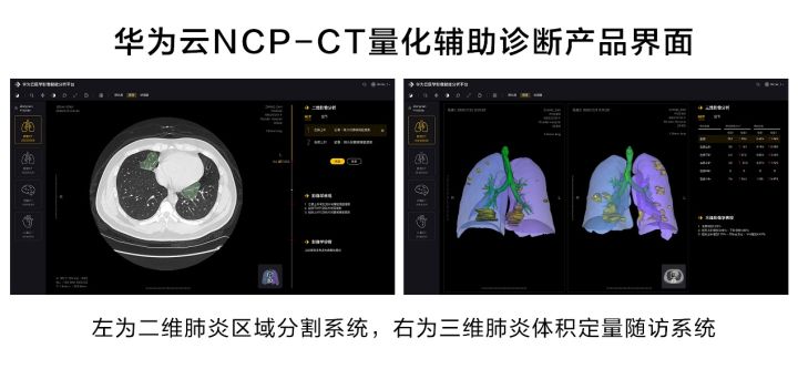 华为云推出新冠肺炎AI辅助诊断服务，CT量化结果秒级输出_华为云