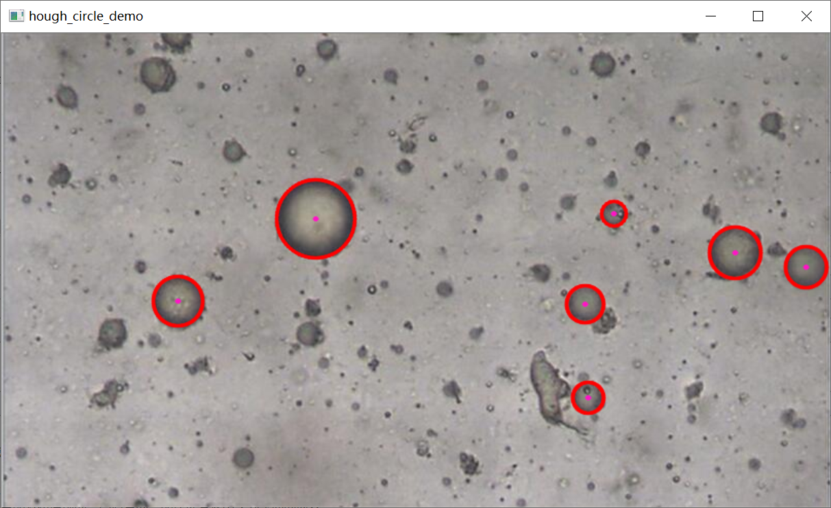 霍夫圆检测_Matlab_03