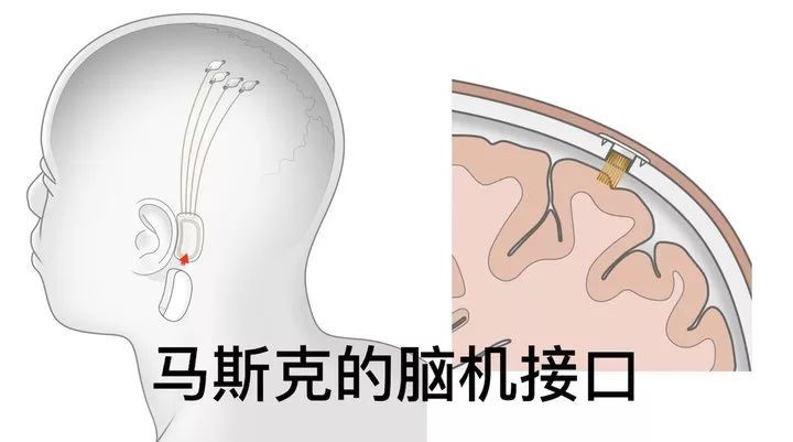 zhenjing！马斯克宣布：脑机交互实现重大突破！_java_02