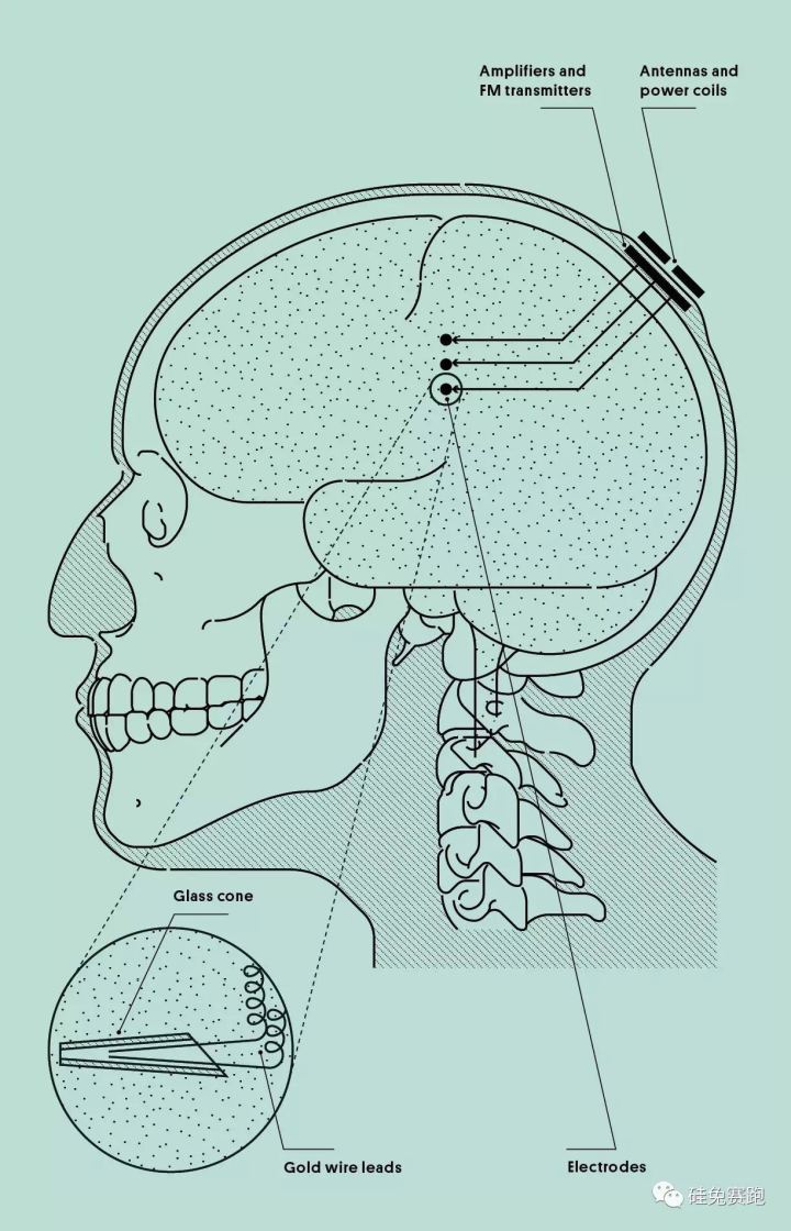 如何评价伊隆·马斯克创办的脑机接口公司 Neuralink ？_人工智能_39