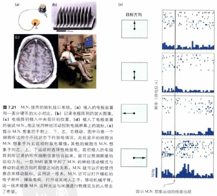 如何评价伊隆·马斯克创办的脑机接口公司 Neuralink ？_人工智能_37