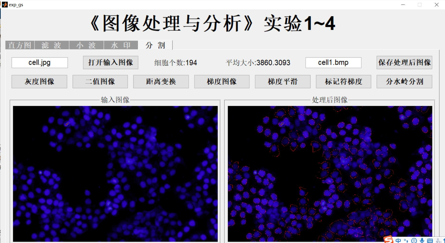 【图像处理】基于图像直方图+滤波+小波变换+分割处理系统matlab源码含 GUI_matlab_14