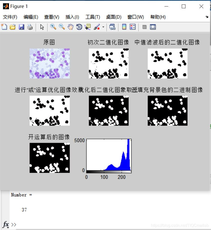 【细胞分割】基于中值滤波+分水岭法实现细胞计数matlab源码_matlab_06