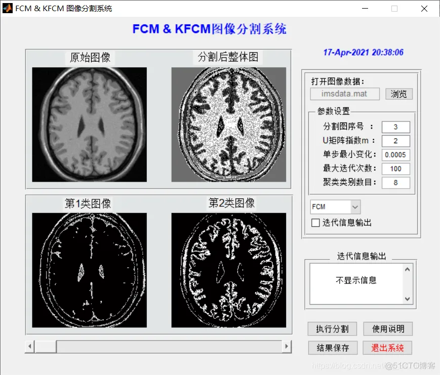 【图像分割】基于FCM和KFCM算法医学图像分割matlab源码含GUI_matlab_13