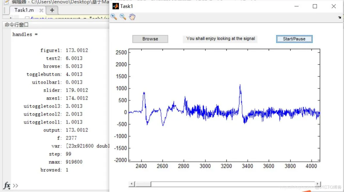 【生物电信号】基于生物电信号仿真matlab源码含 GUI_matlab_03