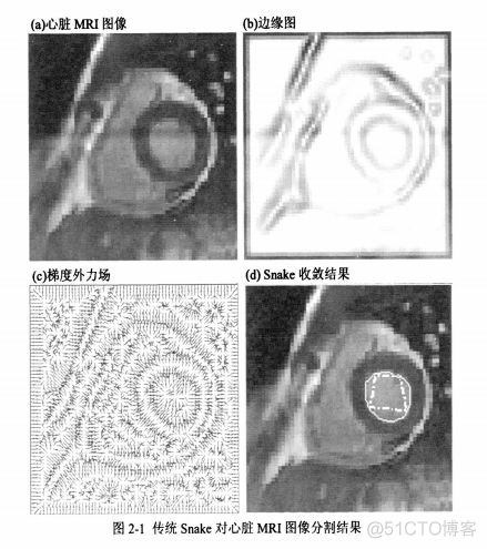 最全综述 | 图像分割算法_图像分割算法_05