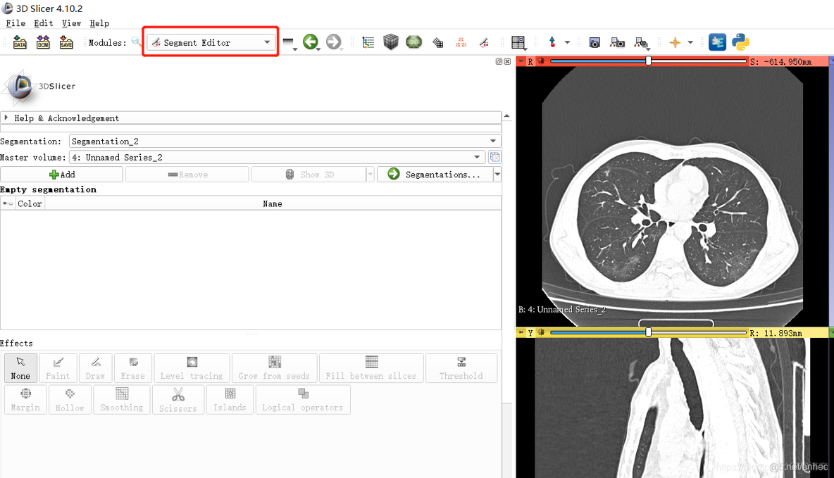 3D Slicer 医学图像检测标注教程(导入查看标签与修改标签)_导入数据_03