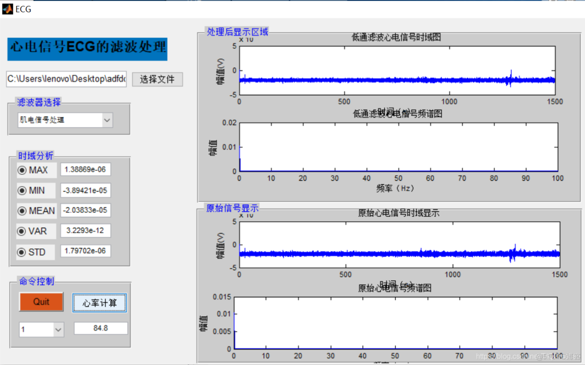 【心电信号】基于matlab心电信号ECG滤波处理【含Matlab源码 1067期】_高通滤波