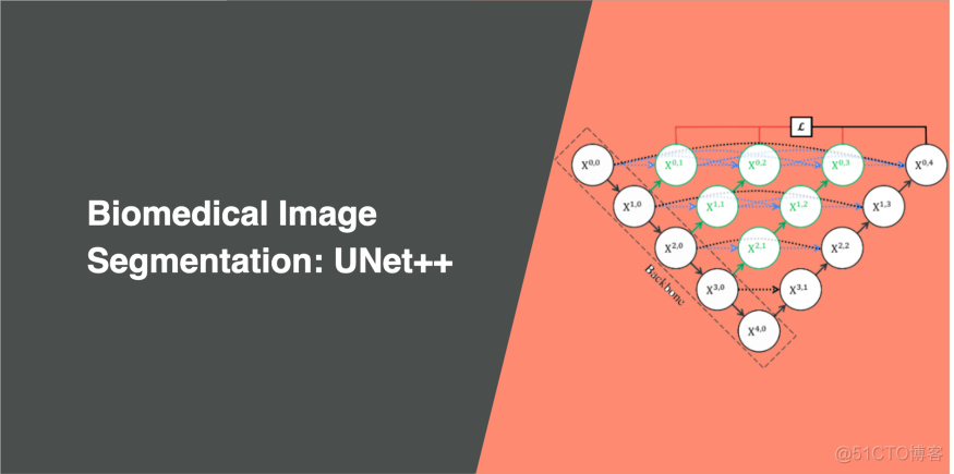 医学图像分割：UNet++_机器学习