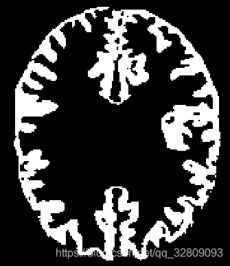 ITK系列18_ 区域增长(连接门限)对脑部MHA文件进行三维分割_图像分割_07