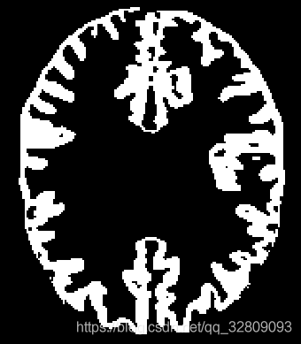 ITK系列18_ 区域增长(连接门限)对脑部MHA文件进行三维分割_实例化_08