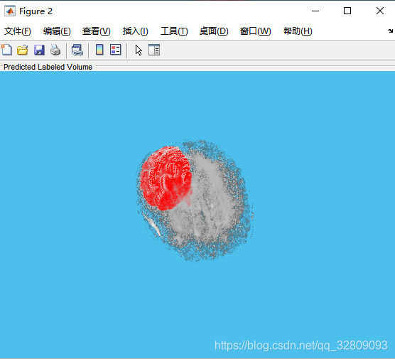 基于Matlab深度学习（Deep Learning）的3-D U-Net 神经网络进行3-D脑部肿瘤(MRI)的分割及三维重建_Matlab_15