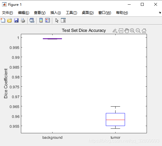 基于Matlab深度学习（Deep Learning）的3-D U-Net 神经网络进行3-D脑部肿瘤(MRI)的分割及三维重建_神经网络_19