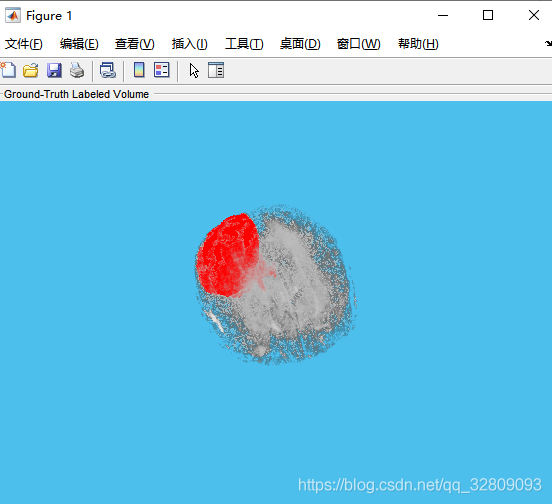 基于Matlab深度学习（Deep Learning）的3-D U-Net 神经网络进行3-D脑部肿瘤(MRI)的分割及三维重建_神经网络_14