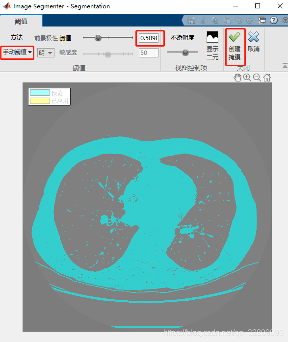 基于Matlab的3-D胸部扫描CT切片的肺部分割——使用活动轮廓(snakes)进行三维分割及建模_二维_17