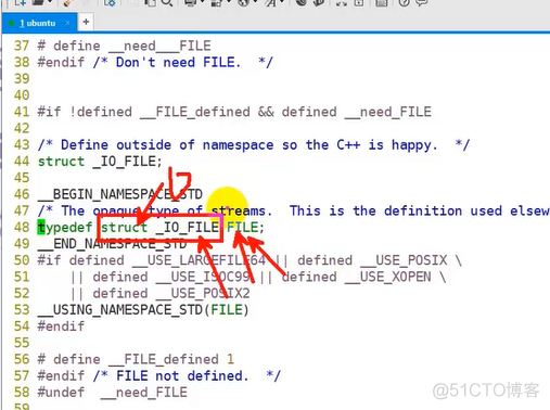 C语言基础 (11) 结构体 ,共用体 枚举 typedef_共用体_19