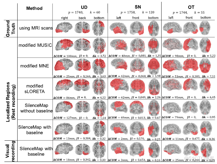 卡内基梅隆大学的研究人员提出新的源定位算法: SilenceMap，寻找大脑的静默区域..._脑机接口_06