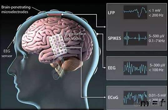 脑控电脑正在成为现实，但重大障碍仍然存在_意念控制_03