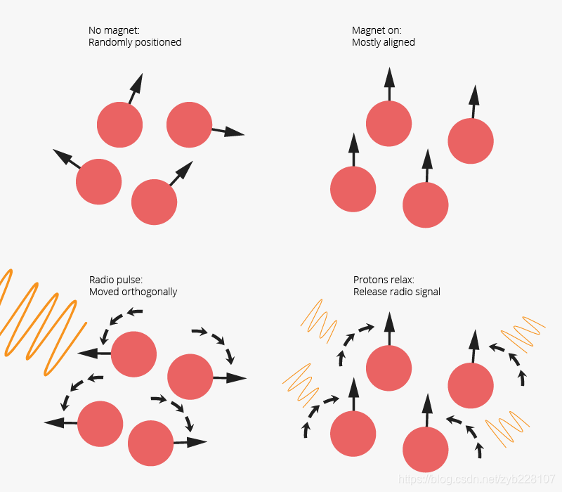 EEG vs MRI vs fMRI vs fNIRS简介_fMRI_02