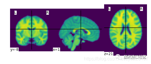 Nilearn中的基本操作和查看_Nilearn_04
