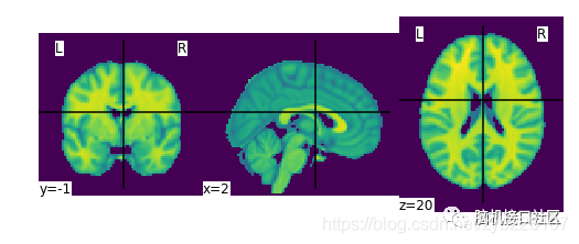 Nilearn中的基本操作和查看_BCI_02