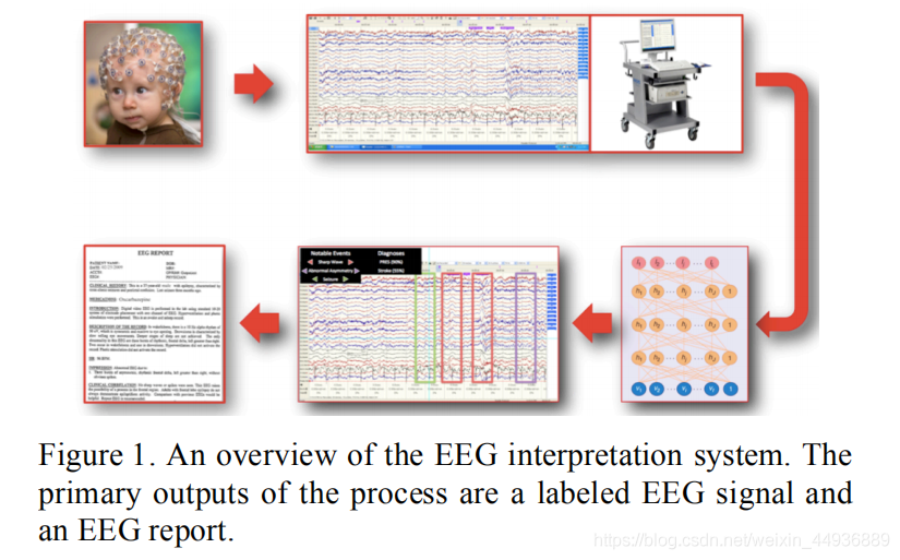 基于深度学习的脑电图识别 数据集篇 脑电信号自动判读的大数据 51cto博客 脑电图判读