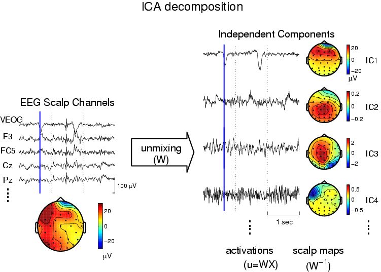 Ica独立成分分析去除脑电伪影 51cto博客 脑电ica独立成分分析原理