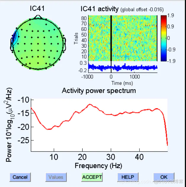 如何识别ICA成分_EEG_09