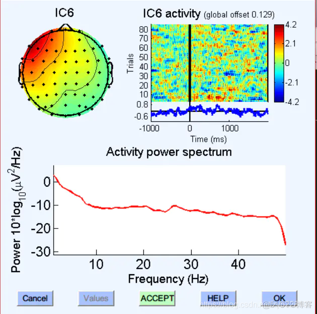 如何识别ICA成分_EEG_15