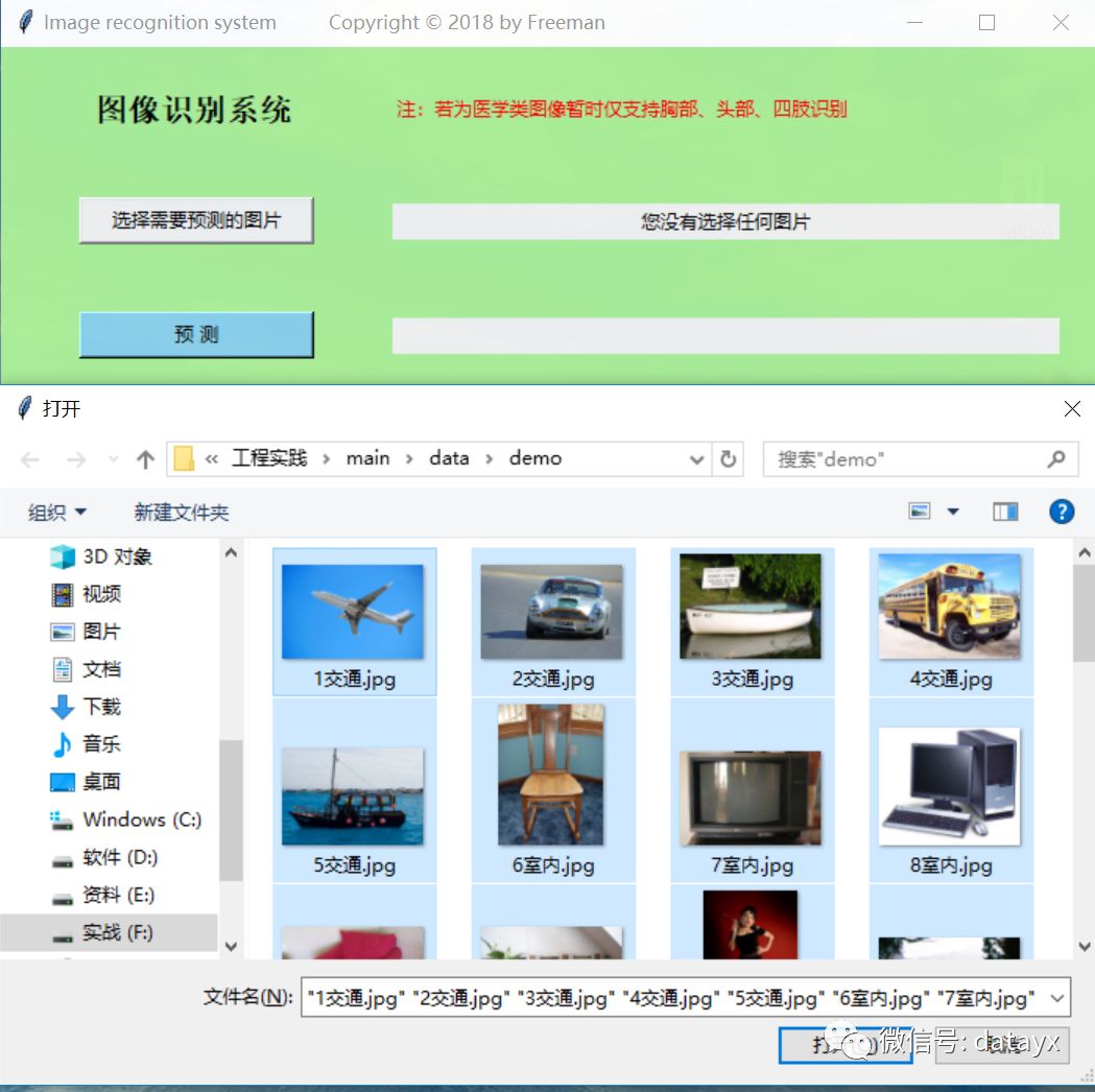 VGG16迁移学习，实现医学图像识别分类工程项目_公众号_03