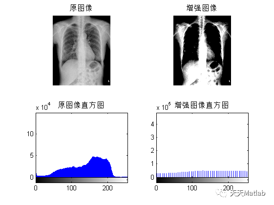 ​【图像分割】基于最小误差法实现胸片分割系统matlab代码_二值化_05